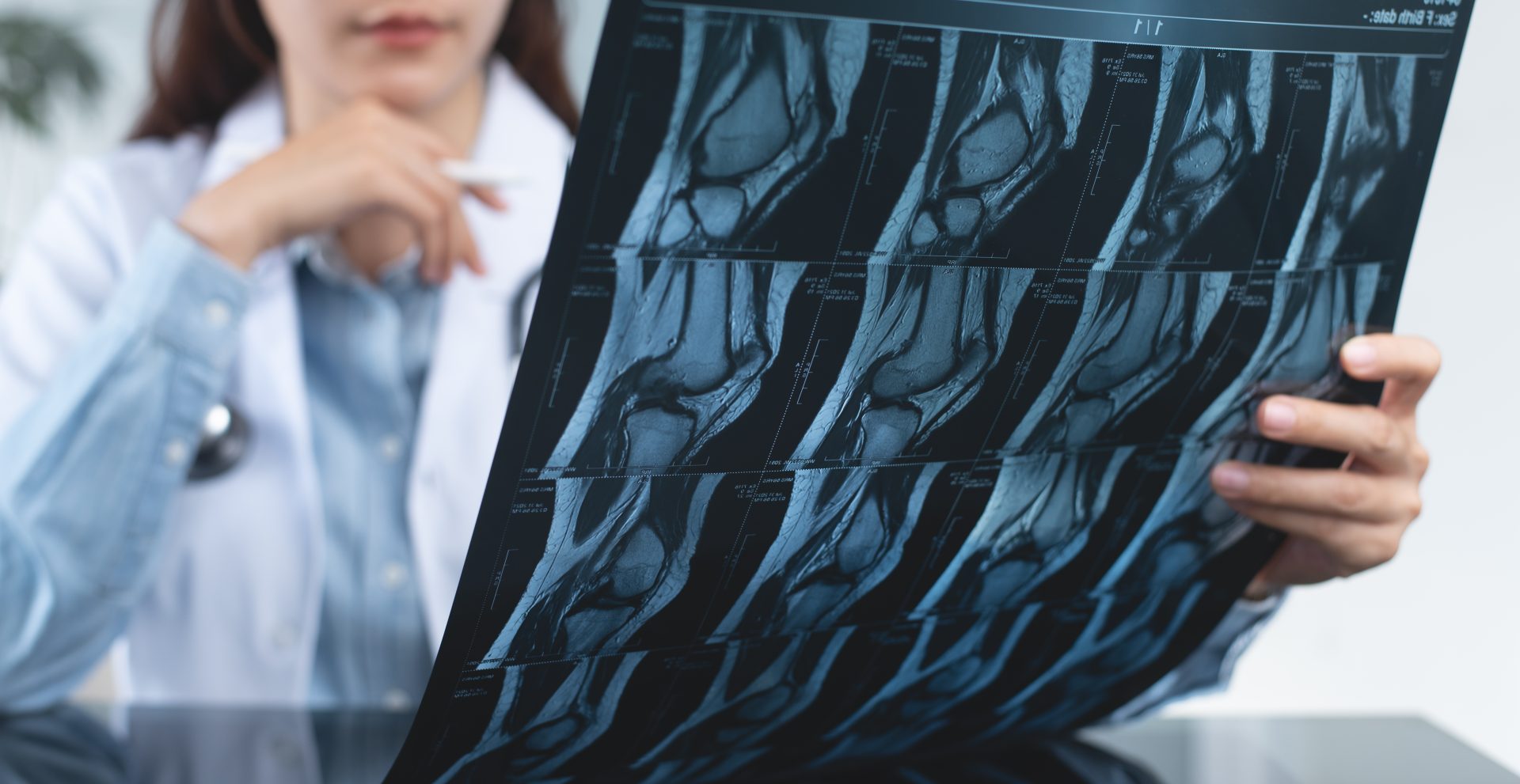 Doctor holding MRI Scan